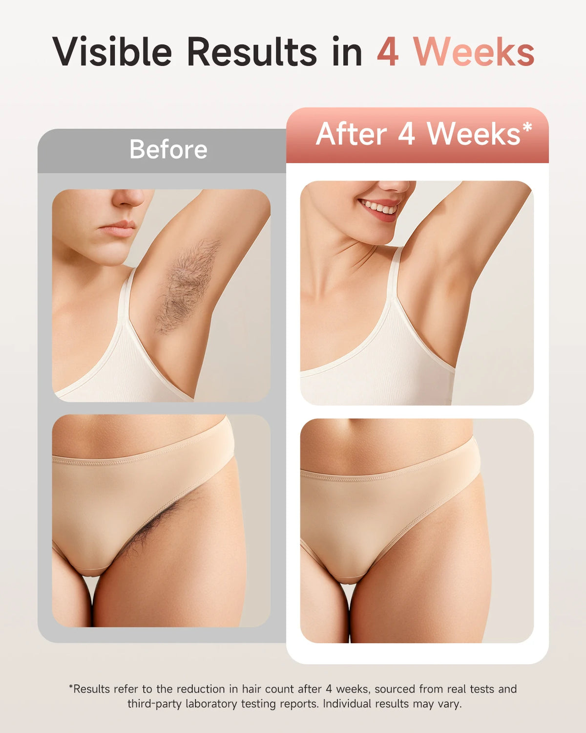 Lysmoski 3 In 1 IPL Hair Removal And Rejuvenation Device