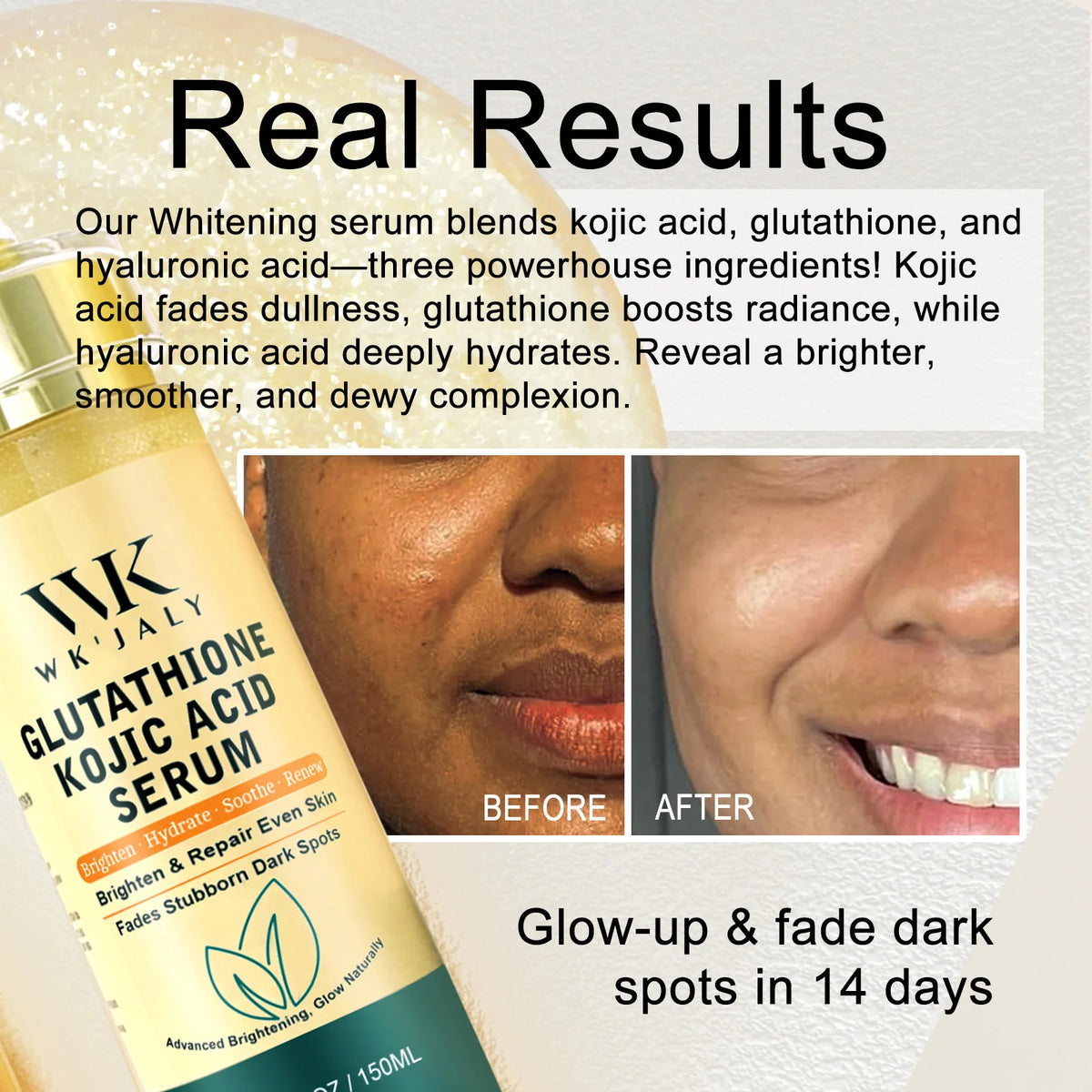 WKJALY Lightening Skin Kit For Women Moisturizing Spot Treatment